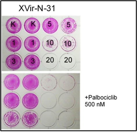 Abbildung 3: Der CDK 4/6 Inhibitor verstärkt deutlich die onkolytische Aktivität von XVir-N-31. Bereits eine MOI von 5 reicht aus, um eine vollständige Tumorlyse zu erzeugen.