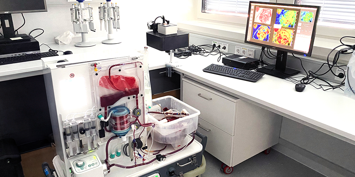 Nierenperfusion.jpg