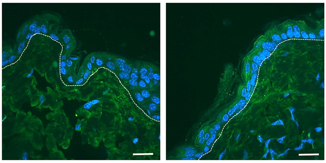 Die Aufnahmen zeigen eine verstärkte Immunofluoreszenzfärbung des antimikrobiellen Peptids mBD3 in PPARα-defizienter Haut (rechts) im Vergleich zur Kontrollhaut (links). Die erhöhte mBD3-Expression unterstreicht die Rolle von PPARα bei der Regulation der angeborenen Immunantwort der Haut. (Bild: Cell, Death & Disease\/Univ.-Klinik für Dermatologie, Allergologie und Venerologie, Innsbruck)